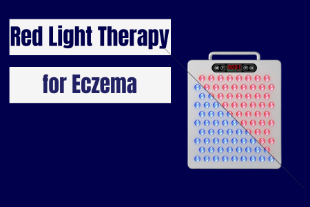 Red Light Therapy for Eczema