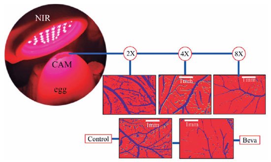 8 applications of 670 nm red light therapy had the equivalent effect as bevacizumab therapy.