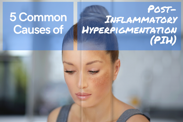 5 Common Causes of Post-Inflammatory Hyperpigmentation (PIH)