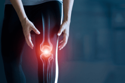 Inflamed knee joint