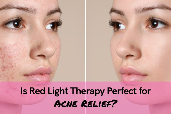 Is Red Light Therapy Perfect for Acne Relief f