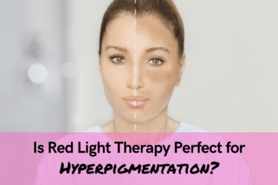 Is Red Light Therapy Perfect for Hyperpigmentation Reduction?
