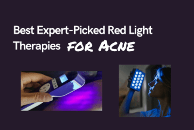 Best Blue Light Therapy for Acne in 2024 (Expert Advice)