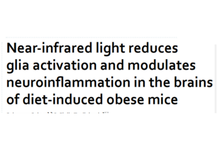 Near‑infrared light reduces glia activation and modulates neuroinfammation in the brains of diet‑induced obese mice