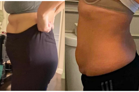 Nushape Lipo Wrap before and after
